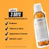 Kiehl’s Calendula Herbal Extract Alcohol-Free Toner, Soothing Facial Toner for Normal to Oily Skin, Visibly Reduces Redness & Oil, Improves Skin Texture, Paraben-Free, Fragrance-Free, Non-acnegenic(8.4 Fl Oz / 250 ml)