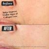 Kiehl’s Super Multi-Corrective Cream, Anti-Aging Wrinkle Reducing Face and Neck Cream, Evens Skin Tone, Smooths Skin Texture, Fast-Absorbing and Lightweight, For All Skin Types, Paraben-free(2.5 Fl Oz / 75 ml)
